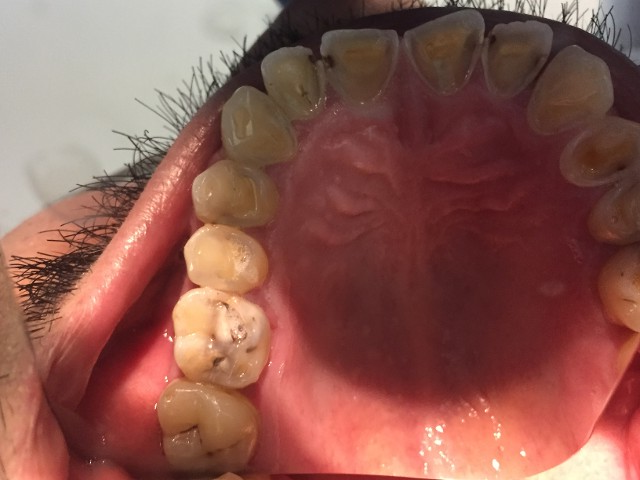 Common Dental Problems